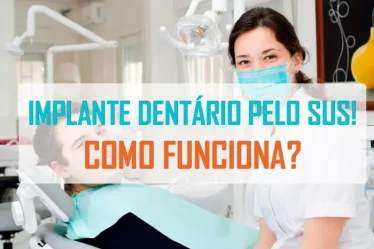 Implante dentário: sorriso bonito ao alcance!