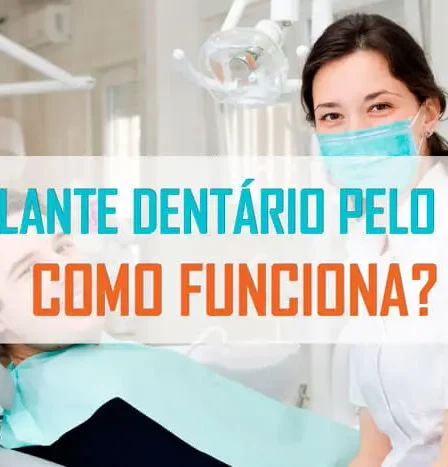 Implante dentário: sorriso bonito ao alcance!